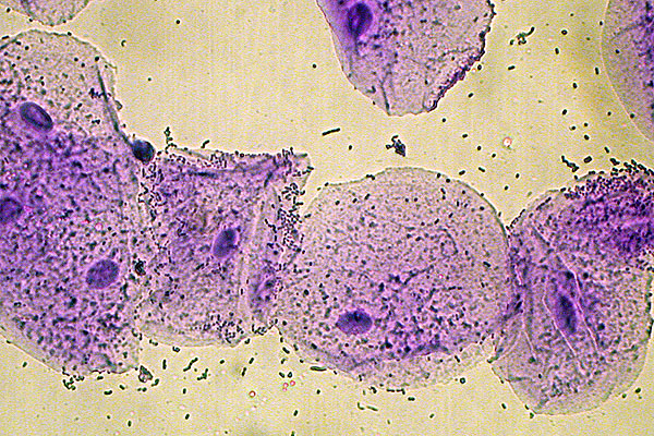 Epithelial cells